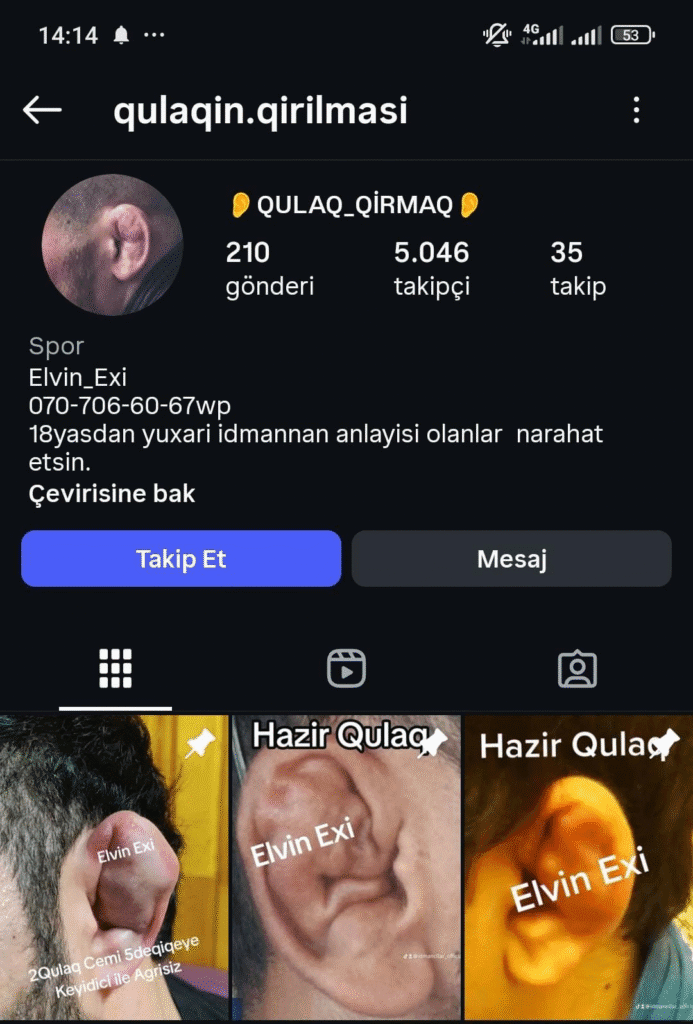 Azərbaycanda narahatedici trend: Gənclər pulla qulaq sındırır
