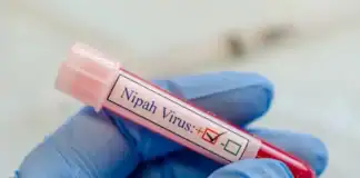 Nipah virusu təhlükəlidirmi? Həkim izah edir