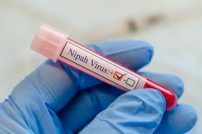 Nipah virusu təhlükəlidirmi? Həkim izah edir